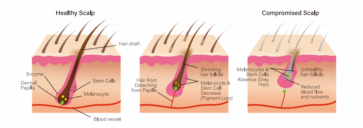 hairna healthy scalp compromised scalp blood vessel 